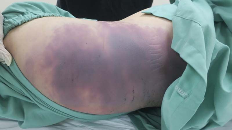 Kiến nghị đổi tội danh người cha trong vụ b&eacute; g&aacute;i 8 tuổi bị bạo h&agrave;nh