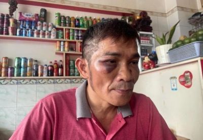 Nguy&ecirc;n nh&acirc;n con trai danh ca Chế Linh bị đ&aacute;nh hội đồng đến bất động